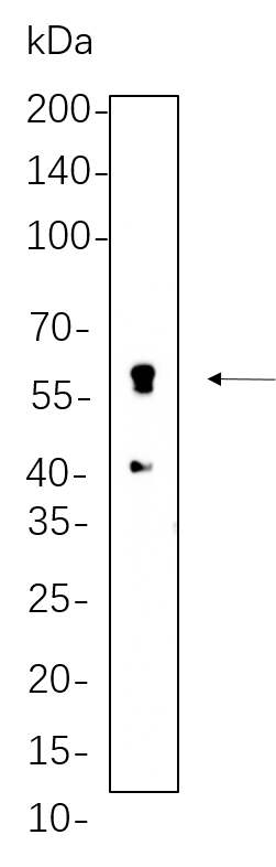 Perilipin-1