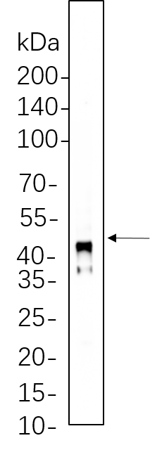 Connexin 43