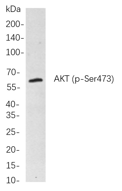 Akt (pan) (Phospho Ser473)