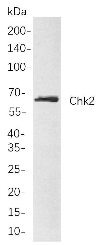 Chk2