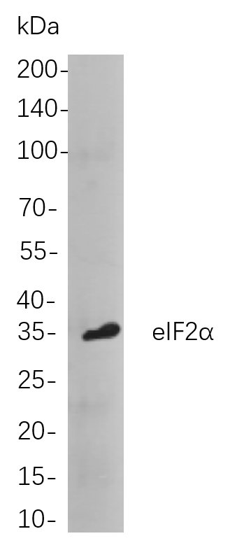 eIF2α