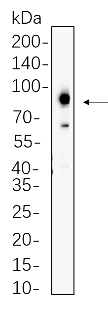 Prostate Specific Membrane Antigen (PSMA)