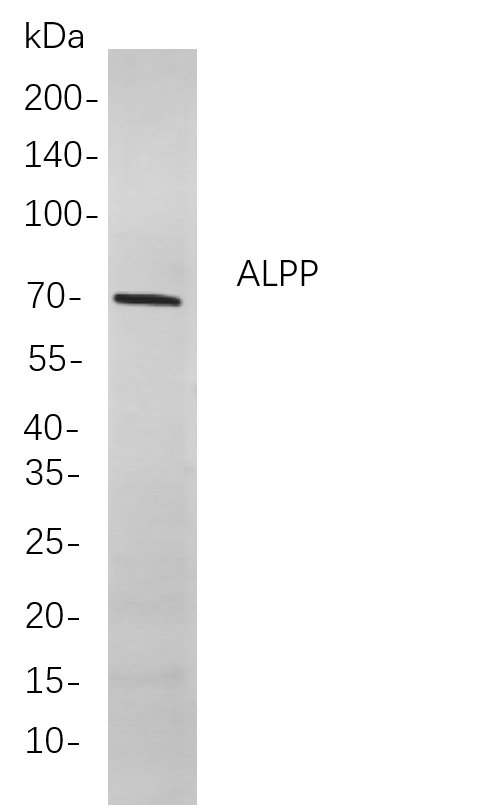ALPP