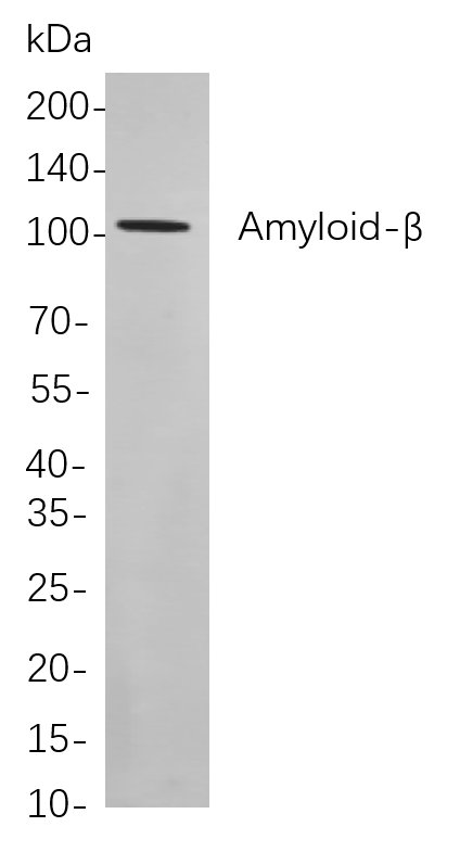 Amyloid-β