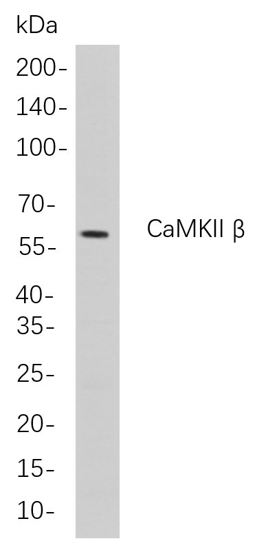 CaMKII β
