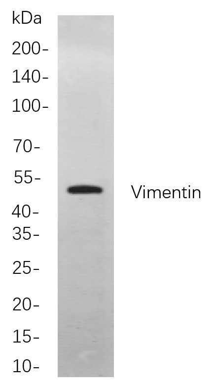 Vimentin
