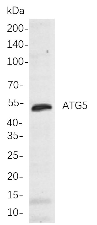ATG5