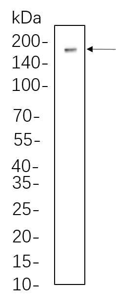 Dnmt1