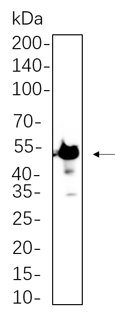 β3 Tubulin