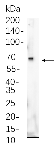 Albumin