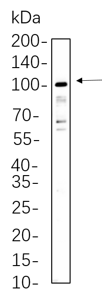 STAT5A/B