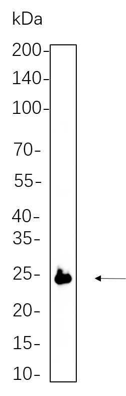 eIF4E