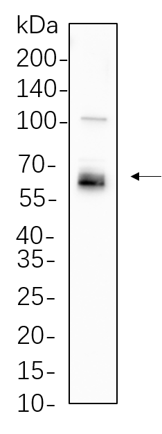 LKB1
