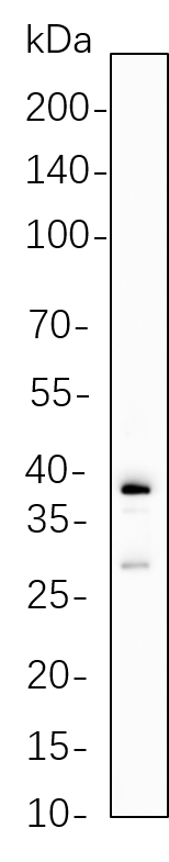 Granzyme B