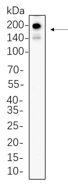 PDGFR-α