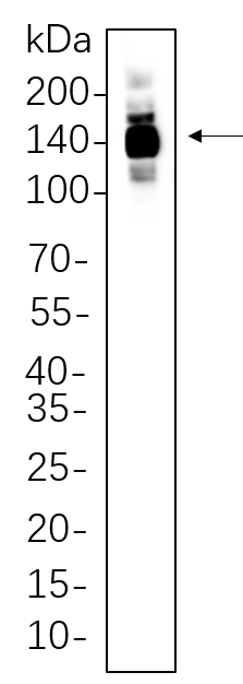 HDAC4