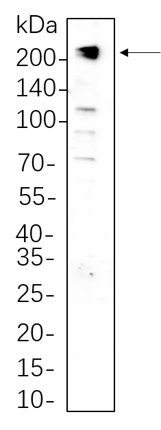 PDGFR-β