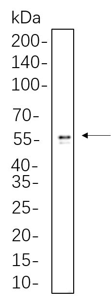 ALDH1A1