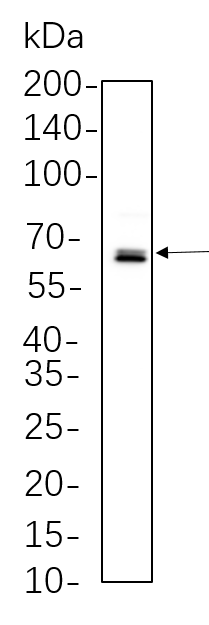 NF-κB p65 (Phospho Ser536)