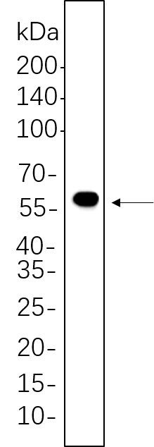 DFNA5/GSDME