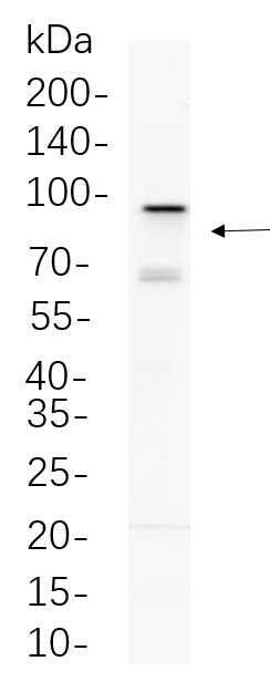 EZH2