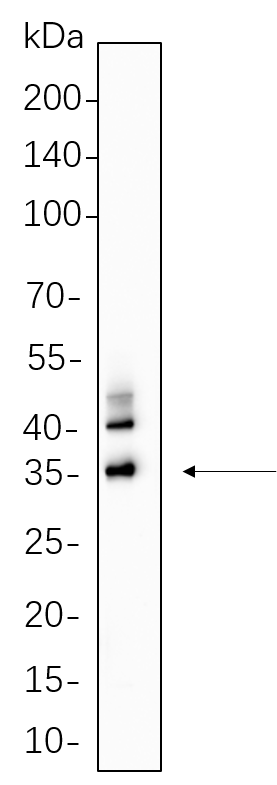 C/EBP α