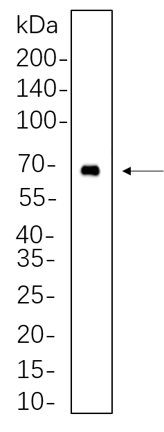 BTK