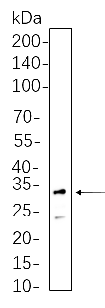 RPS6