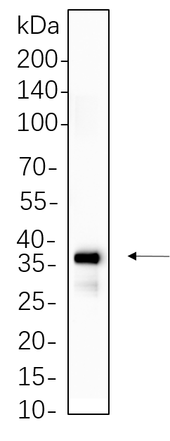 Cleaved N-terminal GSDMD