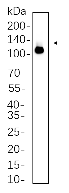 DDX58