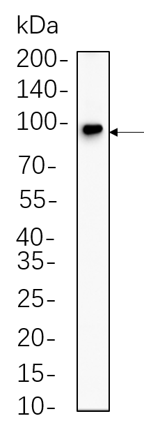 Insulin Receptor β