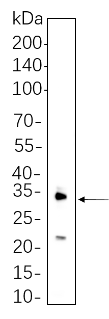 IL-1 β