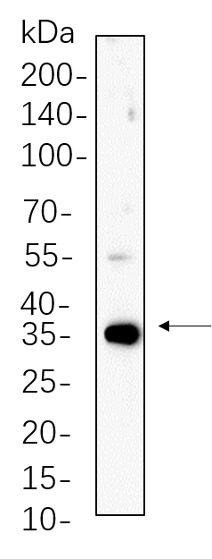PP1α/β