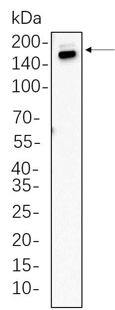 Thrombospondin 1
