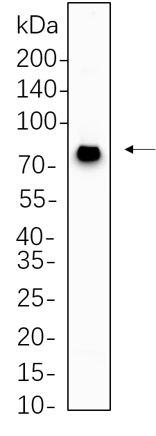 MECP2