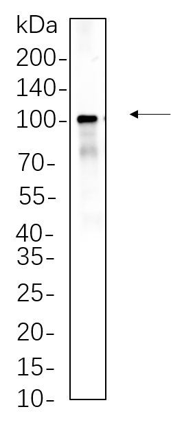 Endoplasmin