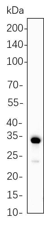 Calponin-1