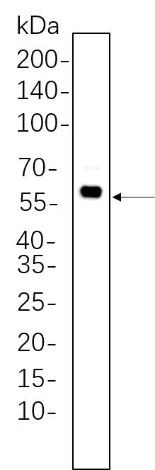 Akt (Phospho Thr308)