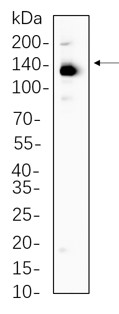 ULK1
