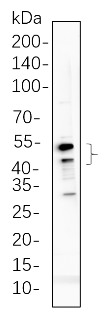 GSK3 α/β (Phospho Tyr216/Tyr279)