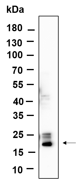 Histone H3 (Tri Methyl Lys4)