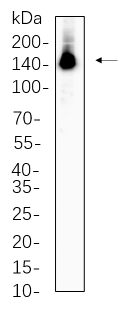 ULK1 (Phospho Ser757)