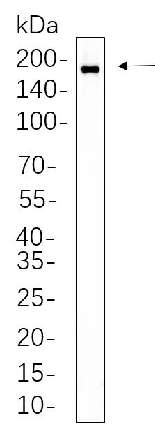 HER2 (Phospho Tyr1221/1222)
