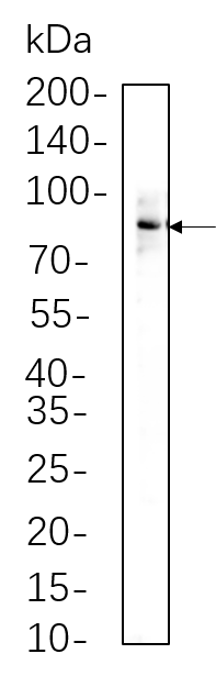 STAT3 (Phospho Tyr705)