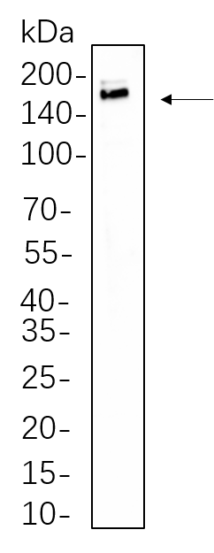 IRS-1