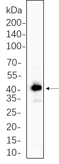 GSK3β