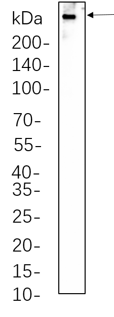Dystrophin