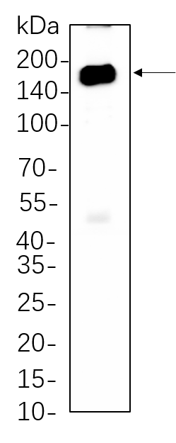 HDAC6