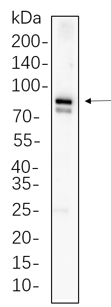 MFN1