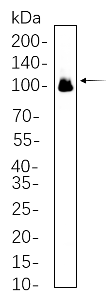 Glutamate Receptor 1